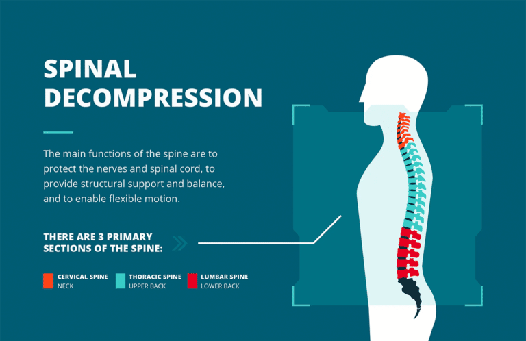 Spinal-Decompression-Therapy-Infographic-1