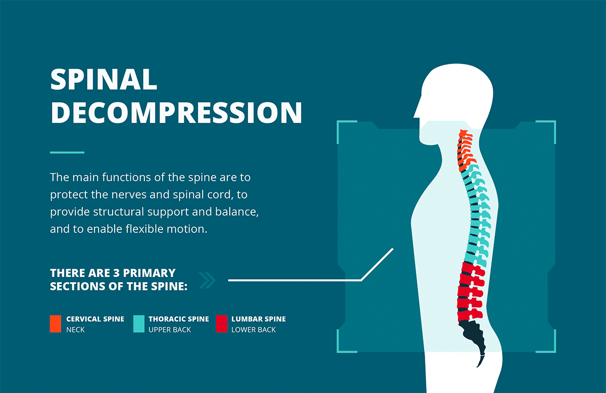 https://momentuminjury.com/wp-content/uploads/2023/02/Spinal-Decompression-Therapy-Infographic-1.png