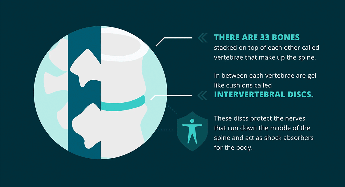 Spinal Decompression Therapy [Infographic] - Momentum Medical