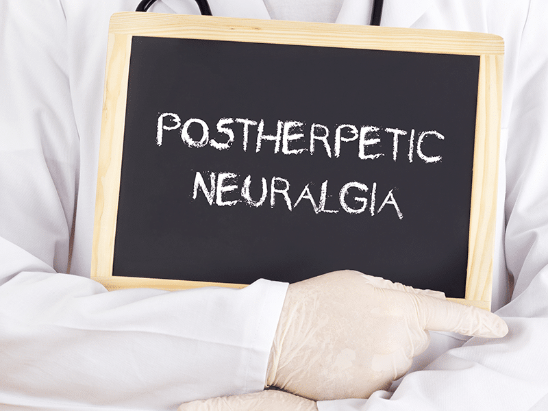 Understanding Postherpetic Neuralgia Symptoms, Causes, and Treatment