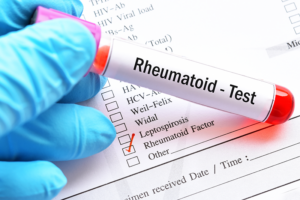 understanding rheumatoid factor_Momentum Medical