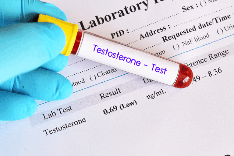 symptoms of low testosterone in men-momentum medical